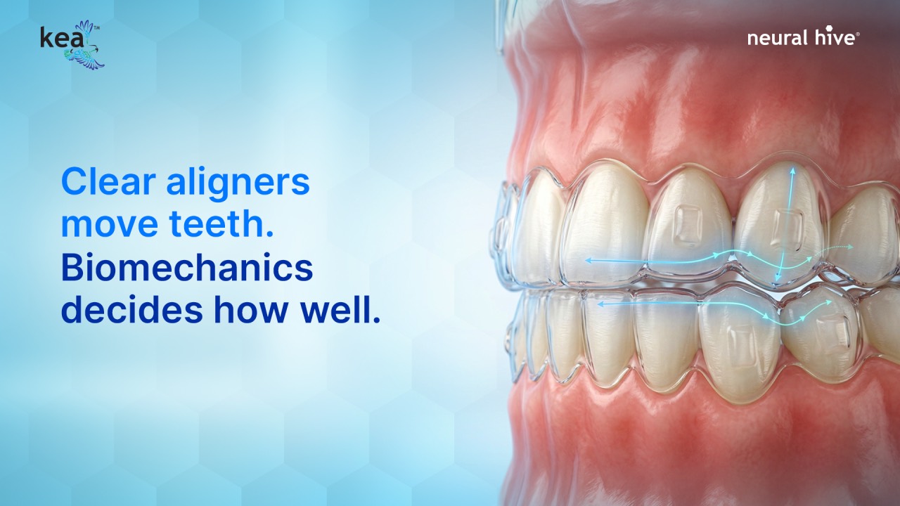 Why Biomechanics Should Drive Every Clear Aligner Decision You Make