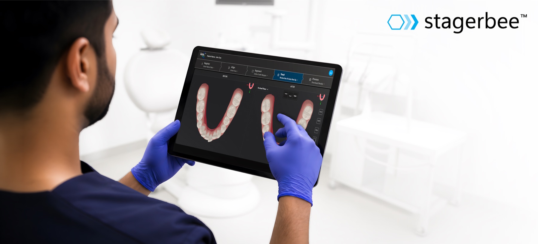 Stagerbee treatment planning in a clinical workflow